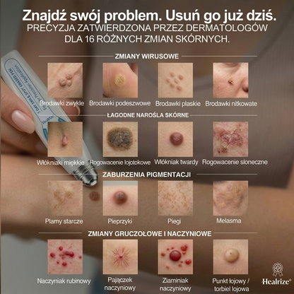 🎉🧨Oficjalny Sklep Markowy |  𝐇𝐞𝐚𝐥𝐫𝐢𝐳𝐞® 7-Dniowy 𝗧𝗮𝗴 & 𝗦𝗽𝗼𝐭 𝐄𝐫𝐚𝐬𝐞𝐫 (Bez bólu, Bez blizn – aplikator z kulką)