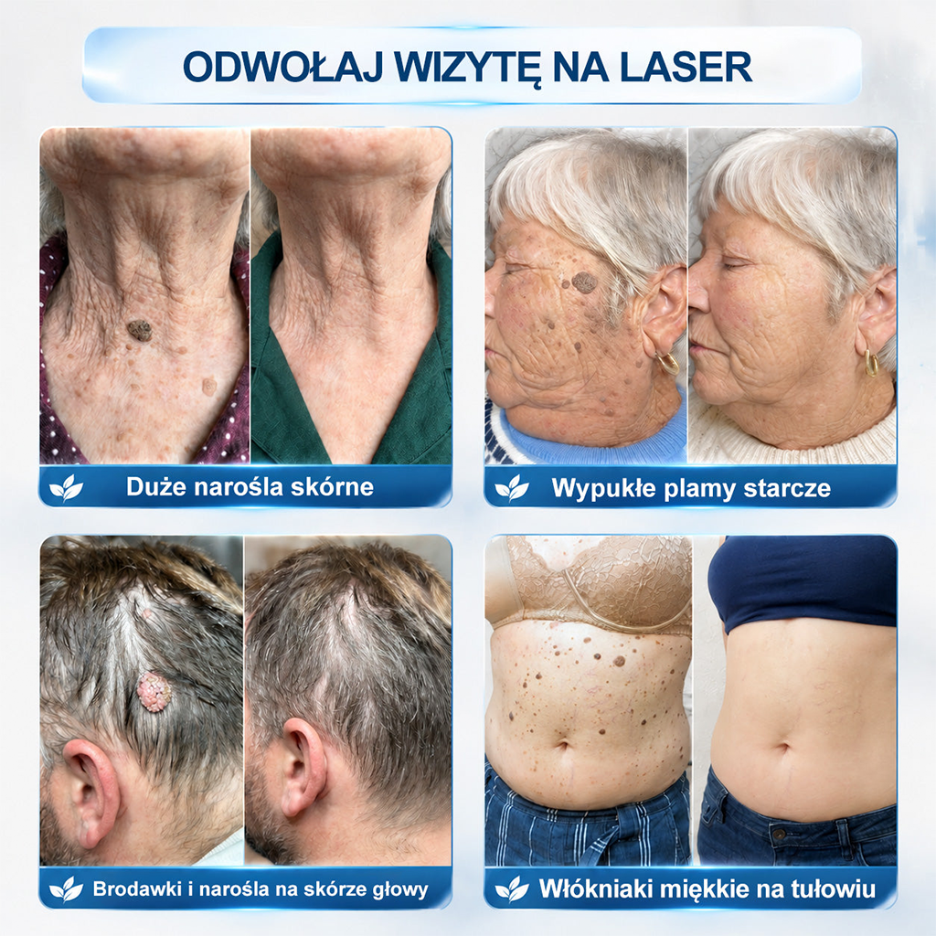 🎉🧨Oficjalny Sklep Markowy |  𝐇𝐞𝐚𝐥𝐫𝐢𝐳𝐞® 7-Dniowy 𝗧𝗮𝗴 & 𝗦𝗽𝗼𝐭 𝐄𝐫𝐚𝐬𝐞𝐫 (Bez bólu, Bez blizn – aplikator z kulką)